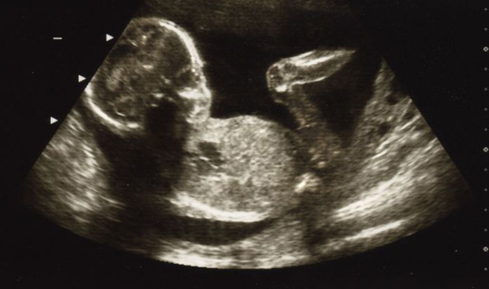 20 weken zwanger, zwangerschap tips, zwangerschap, babylabel, baby-label, zwangerschaps blog