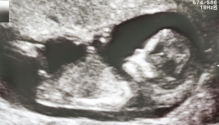 twaalf weken zwanger, babylabel , tips zwangerschap