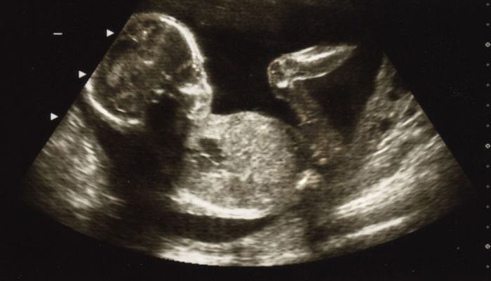 20 weken zwanger, zwangerschap tips, zwangerschap, babylabel, baby-label, zwangerschaps blog