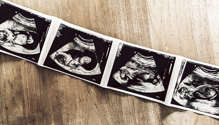 16 weken controle, 16 weken controle zwangerschap, 16 weken zwanger
